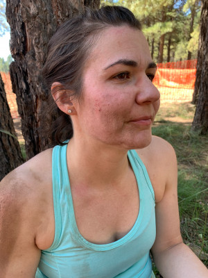 Just a little tumble working on mountain bike skills.